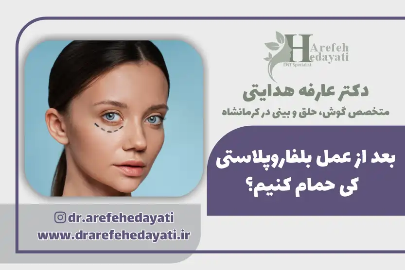 بعد از عمل بلفاروپلاستی کی حمام کنیم؟