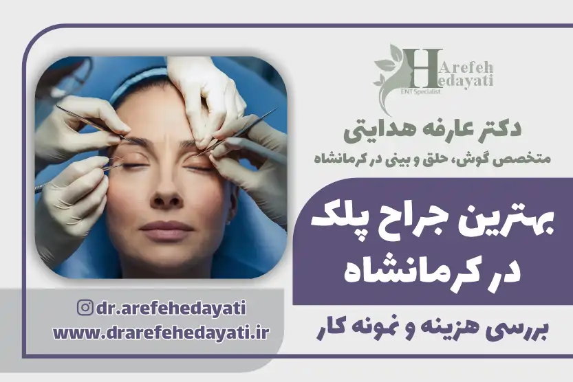 بهترین جراح پلک در کرمانشاه: بررسی هزینه عمل پلک و نمونه کار بهترین جراح