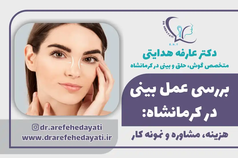 بررسی عمل بینی کرمانشاه توسط بهترین جراح بینی در کرمانشاه
