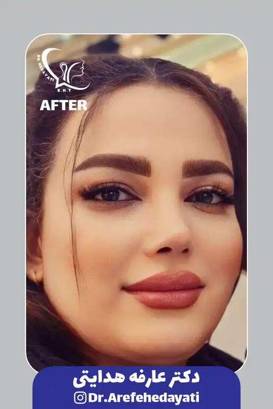 بعد نمونه کار دکتر عارفه هدایتی 2
