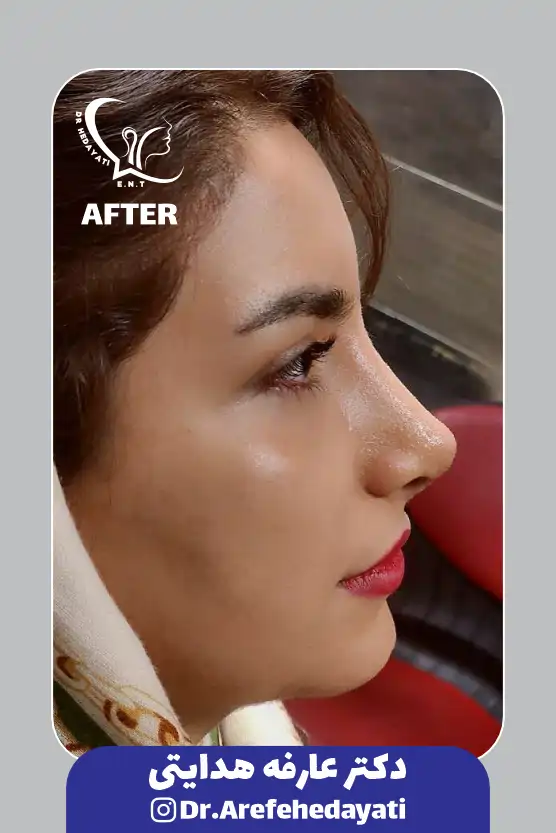 بعد نمونه کار دکتر عارفه هدایتی 8