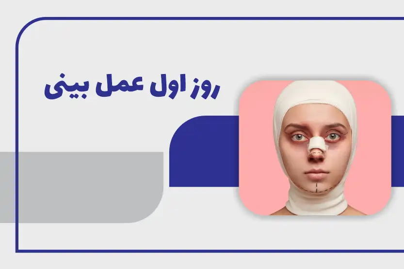 روز اول عمل بینی