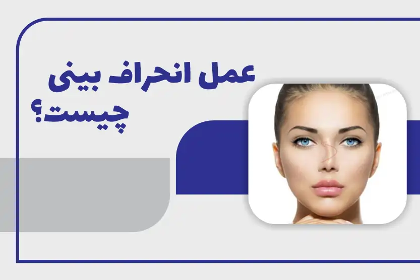 عمل انحراف بینی چیست