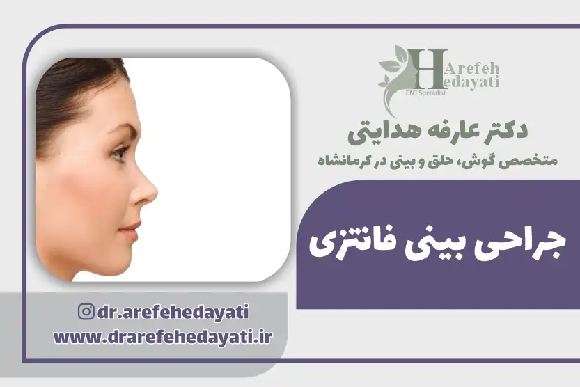 جراحی بینی فانتزی کرمانشاه