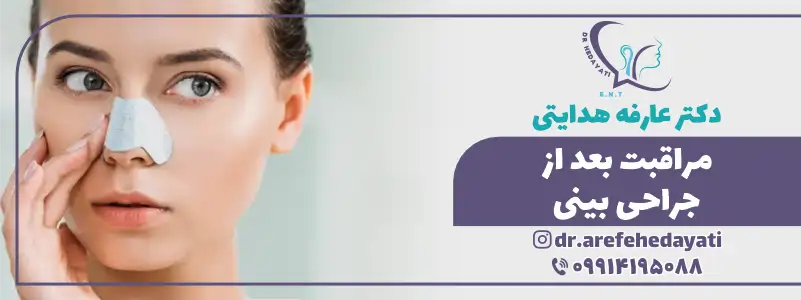 مراقبت بعد از جراحی بینی