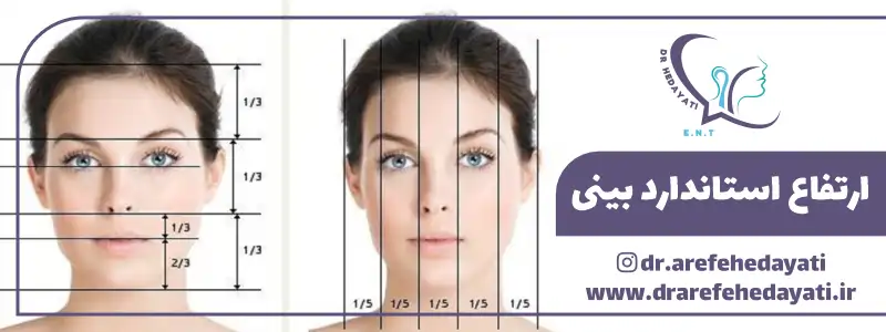 ارتفاع استاندارد بینی