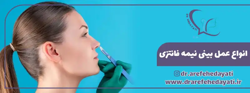 انواع عمل بینی نیمه فانتزی