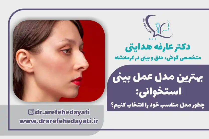 بهترین مدل عمل بینی استخوانی