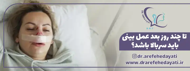 تا چند روز بعد عمل بینی باید سربالا باشد؟