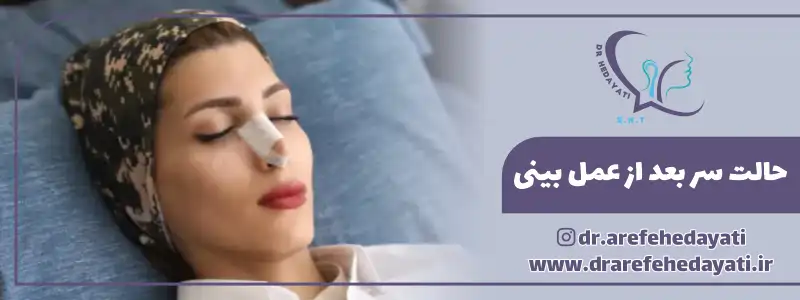 حالت سر بعد از عمل بینی