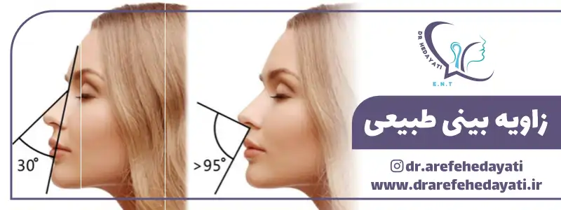 زاویه بینی طبیعی