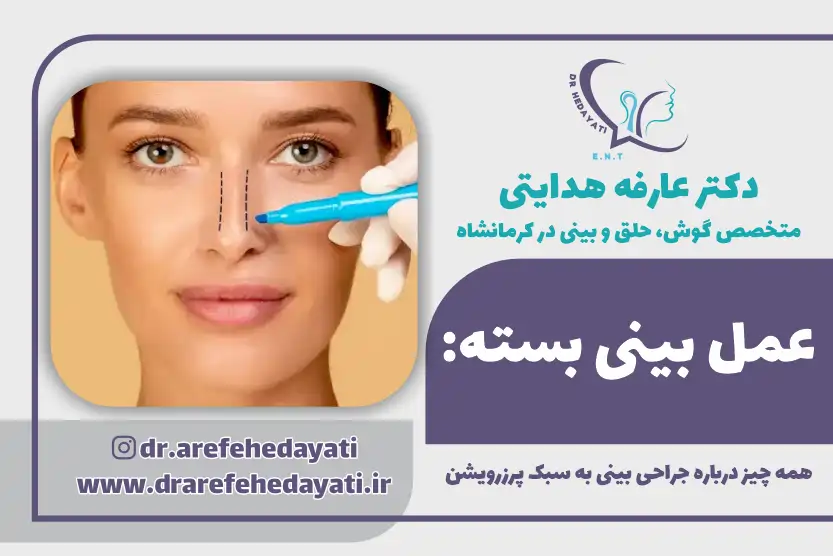 عمل بینی بسته چیست؟