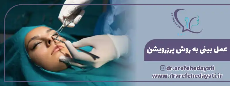 عمل بینی به روش پرزرویشن