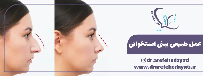 مدل طبیعی بینی استخوانی