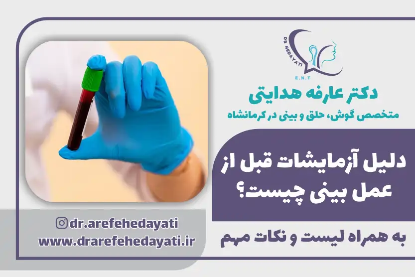 دلیل آزمایشات قبل عمل بینی چیست؟ به همراه لیست و نکات مهم