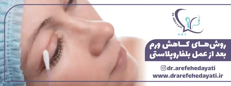 روش های کاهش ورم بعد از عمل بلفاروپلاستی
