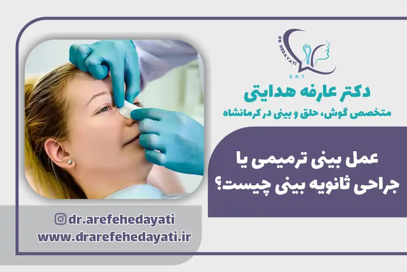 عمل بینی ترمیمی یا جراحی ثانویه بینی چیست
