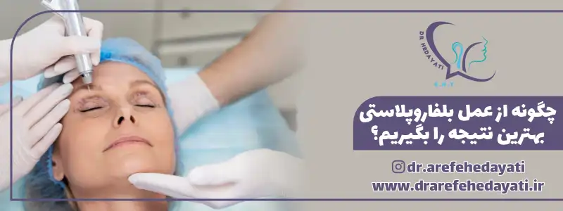 چگونه از عمل بلفاروپلاستی بهترین نتیجه را بگیریم؟