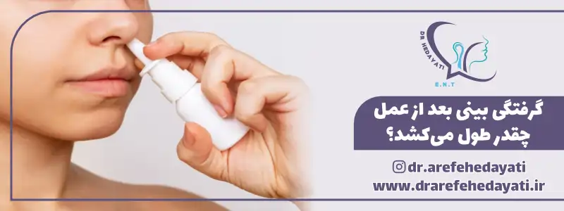 گرفتگی بینی بعد از عمل چقدر طول میکشد