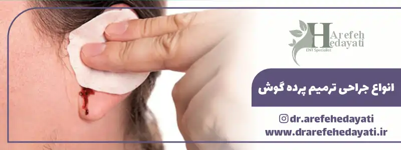 انواع جراحی ترمیم پرده گوش