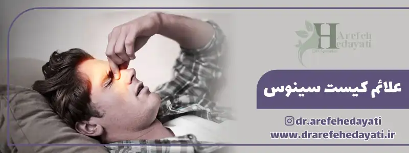 علائم کیست سینوس