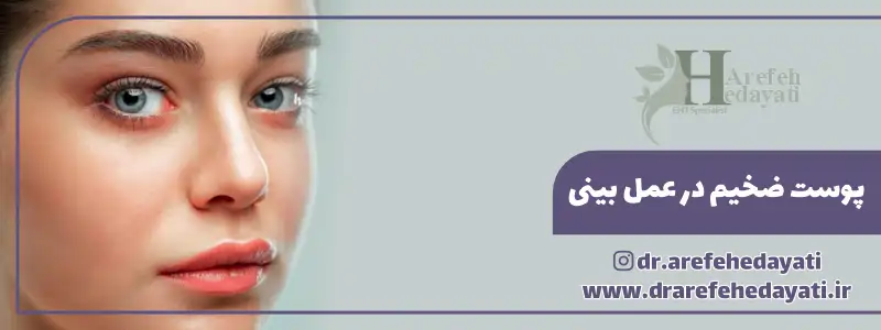 پوست ضخیم در عمل بینی