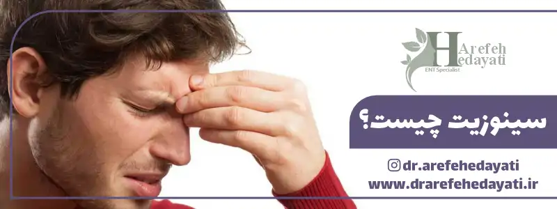 سینوزیت چیست؟
