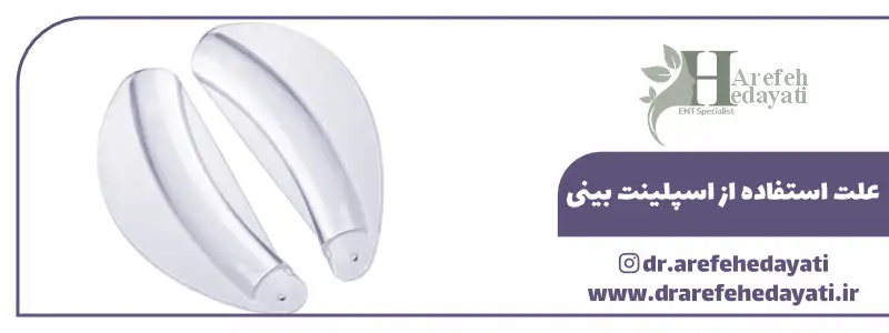 علت استفاده از اسپلینت بینی