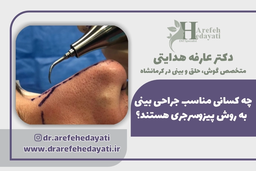 چه کسانی مناسب جراحی بینی به روش پیزوسرجری هستند؟