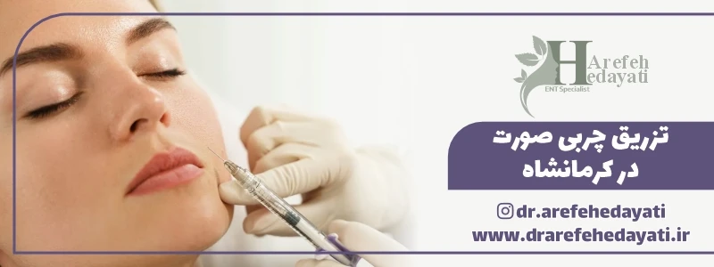 تزریق چربی صورت در کرمانشاه