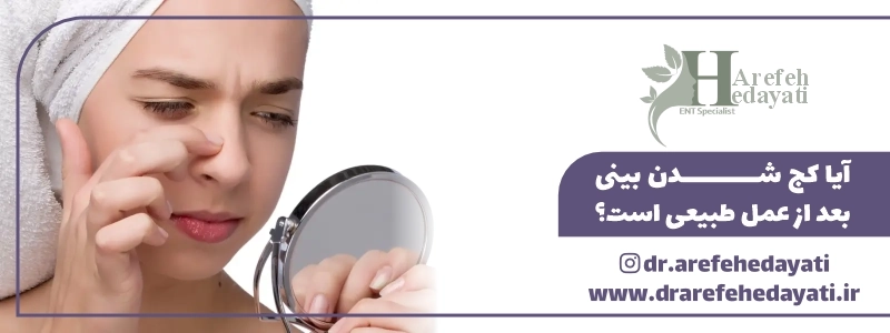 آیا کج شدن بینی بعد از عمل طبیعی است؟