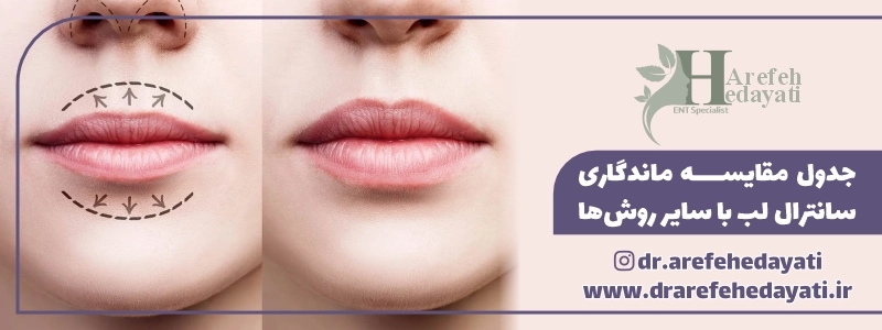 جدول مقایسه ماندگاری سانترال لب با سایر روش_ها