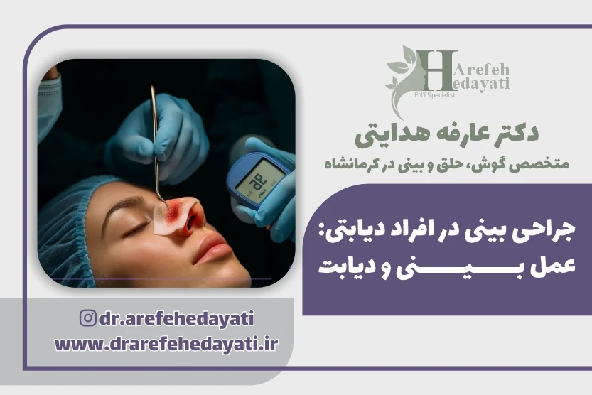جراحی بینی در افراد دیابتی عمل بینی و دیابت