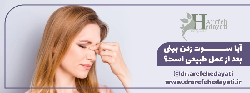 آیا سوت زدن بینی بعد از عمل طبیعی است؟
