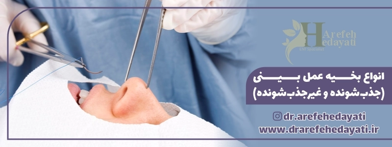 انواع بخیه عمل بینی (جذب_شونده و غیرجذب_شونده)
