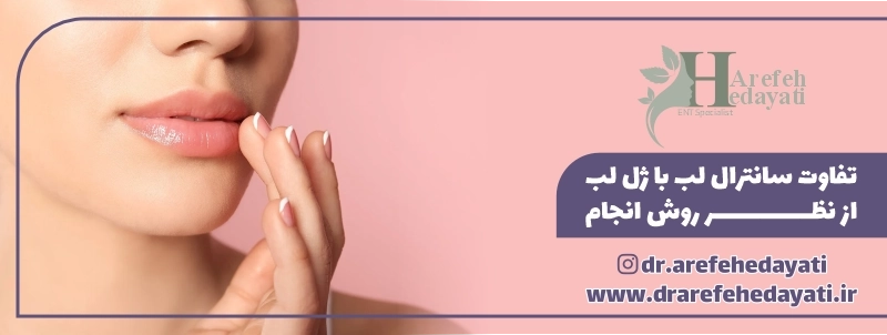 تفاوت سانترال لب با ژل لب از نظر روش انجام