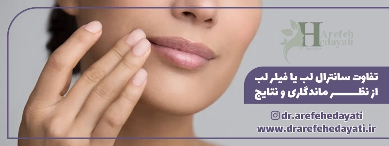 تفاوت سانترال لب یا فیلر لب از نظر ماندگاری و نتایج