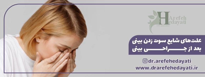 علت_های شایع سوت زدن بینی بعد از جراحی بینی