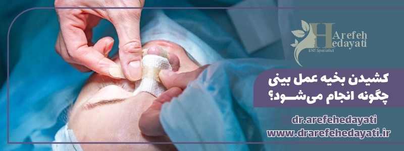 کشیدن بخیه عمل بینی چگونه انجام می_شود؟