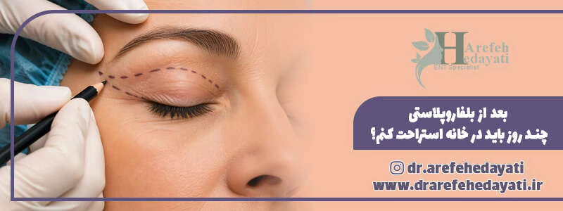 بعد از بلفاروپلاستی چند روز باید در خانه استراحت کنم؟