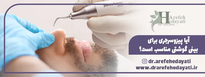 آیا پیزوسرجری برای بینی گوشتی مناسب است؟