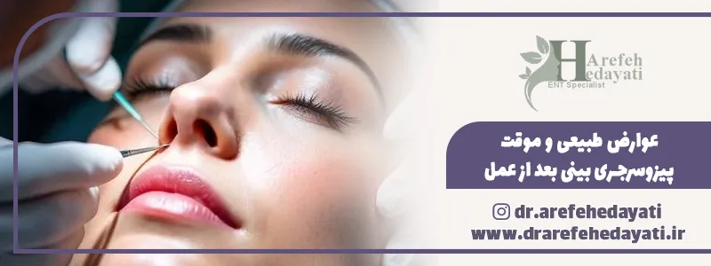 عوارض طبیعی و موقت پیزوسرجری بینی بعد از عمل