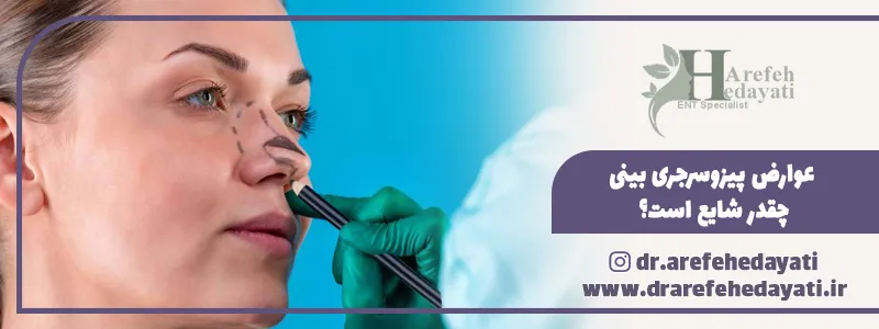عوارض پیزوسرجری بینی چقدر شایع است؟