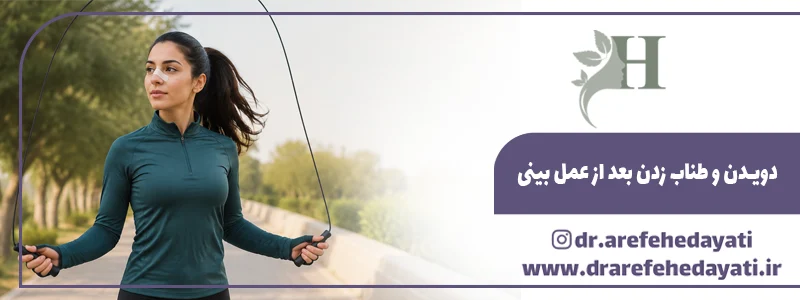 دویدن و طناب زدن بعد از عمل بینی
