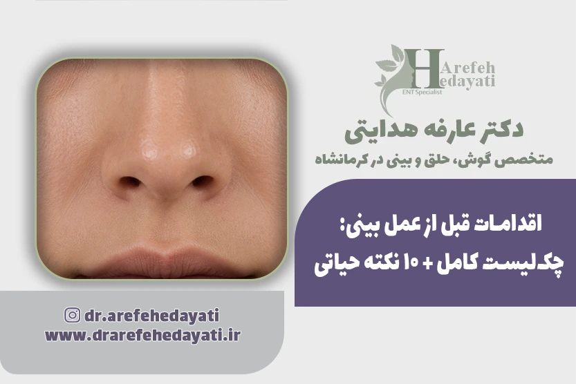 اقدامات قبل از عمل بینی چک_لیست کامل + ۱۰ نکته حیاتی